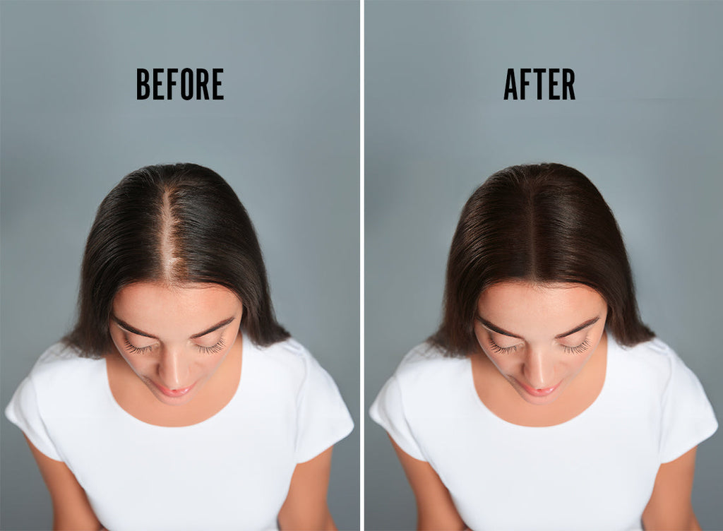 SCALP THERAPY - 90 DAY SUPPLY