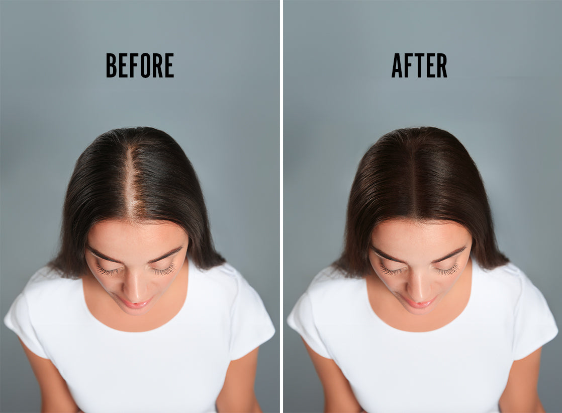 SCALP THERAPY - 90 DAY SUPPLY