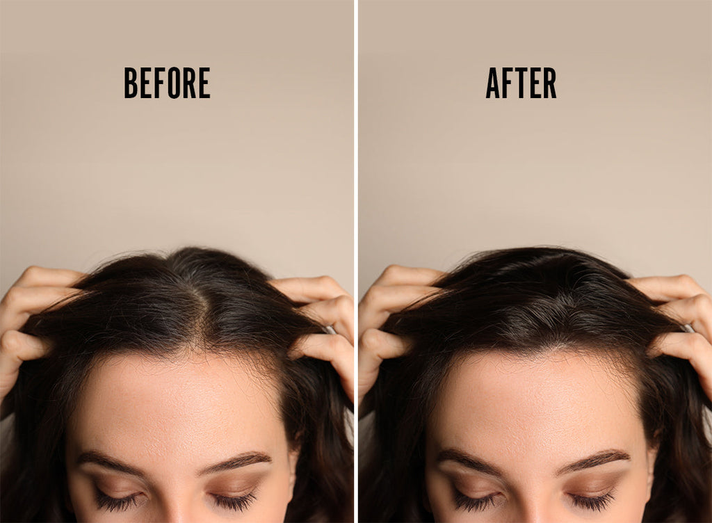 REVIVOGEN MD BIO-CLEANSING SHAMPOO & THICKENING CONDITIONER KIT